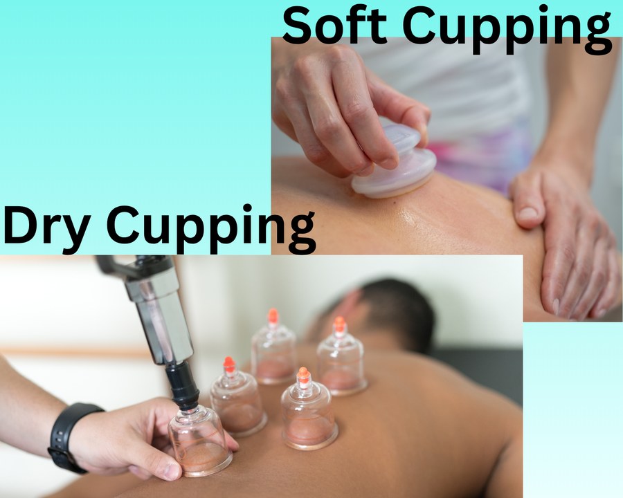 Soft cupping and dry cupping being performed by a physical therapist